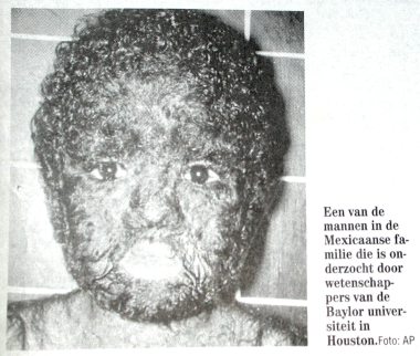 Man met pelsgroei