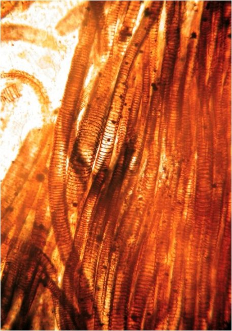 Xyleem van Asteroxylon mackiei