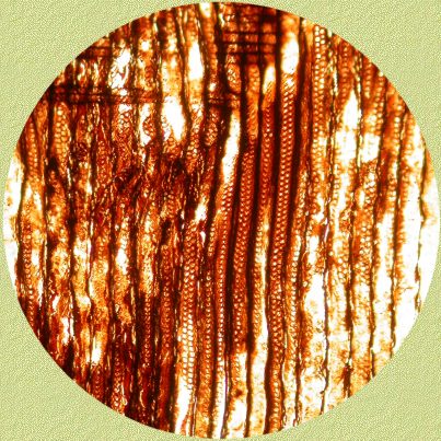 Araucaroide stippeling 100 x