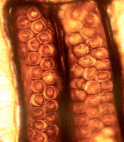 Araucaroide hofstippeling