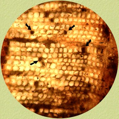 Parenchymcellen