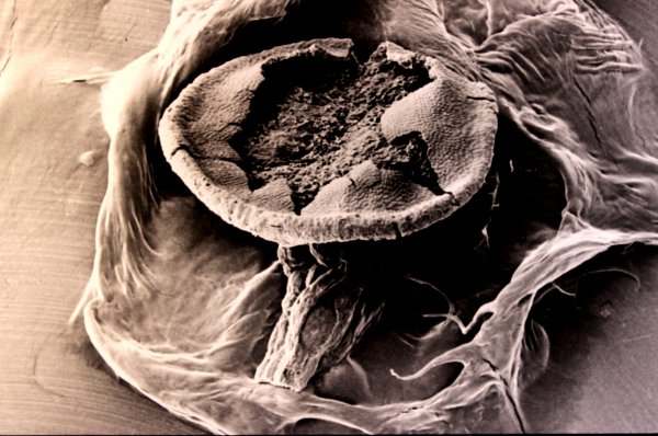 Sporangium van Cooksonia pertoni