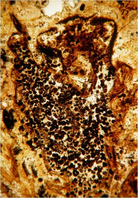 Sporangium van Horneophyton
