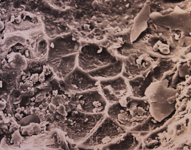 Pseudocelstructuur van Nematothallus