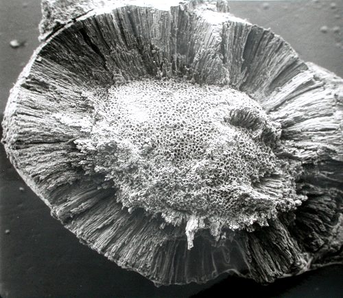 SEM-foto Pachytheca