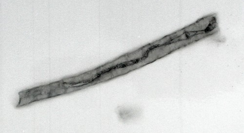 SEM-foto Pachytheca