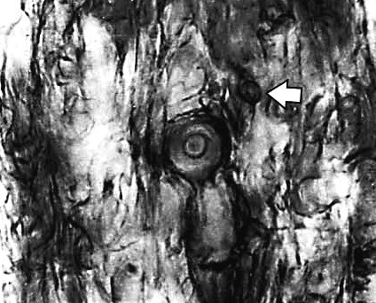 Dolipore bij Prototaxites