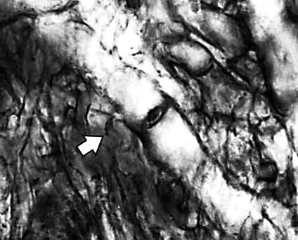 Dolipore bij Prototaxites