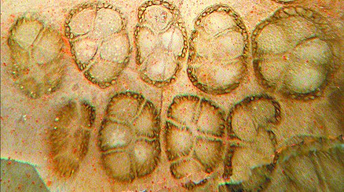 Transverse section of synangia of Scolecopteris