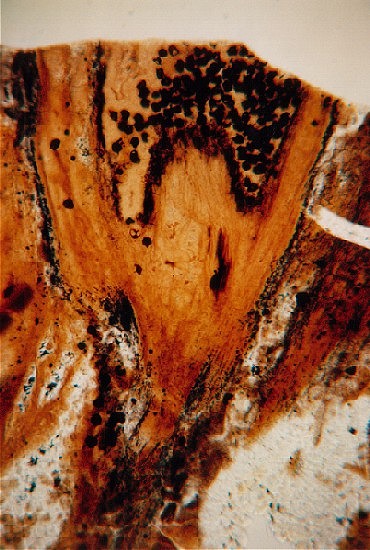 Sporangium van Horneophyton