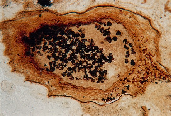 Sporangium van Horneophyton