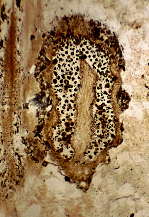 Sporangium met columella