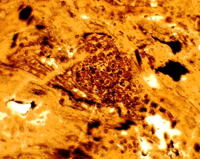 Sporangium van Nothia